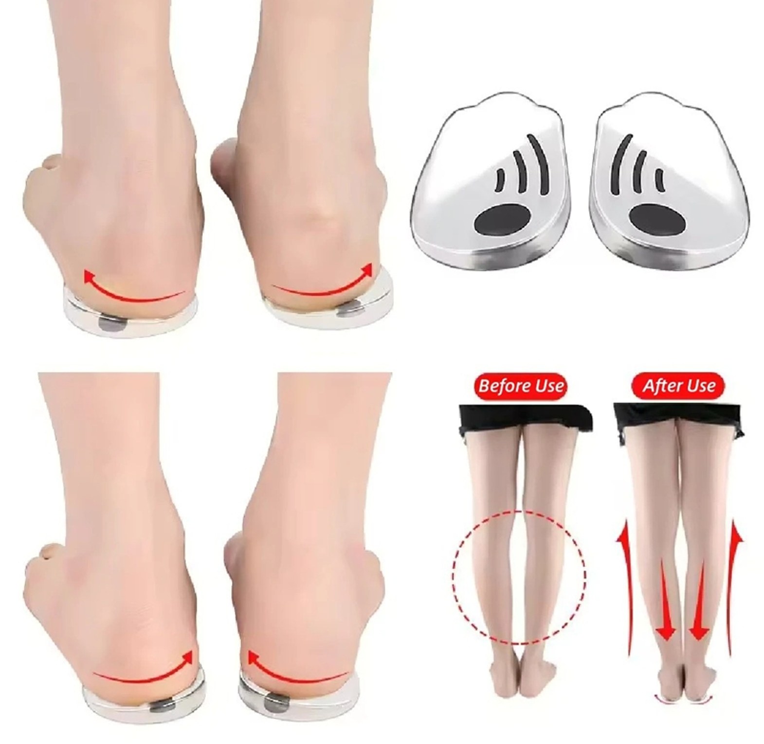Orthopedic Silicone Heel Wedge Insoles for O-Leg and X-Leg Correction, Medically Designed Leg Alignment Pads for Men & Women  image