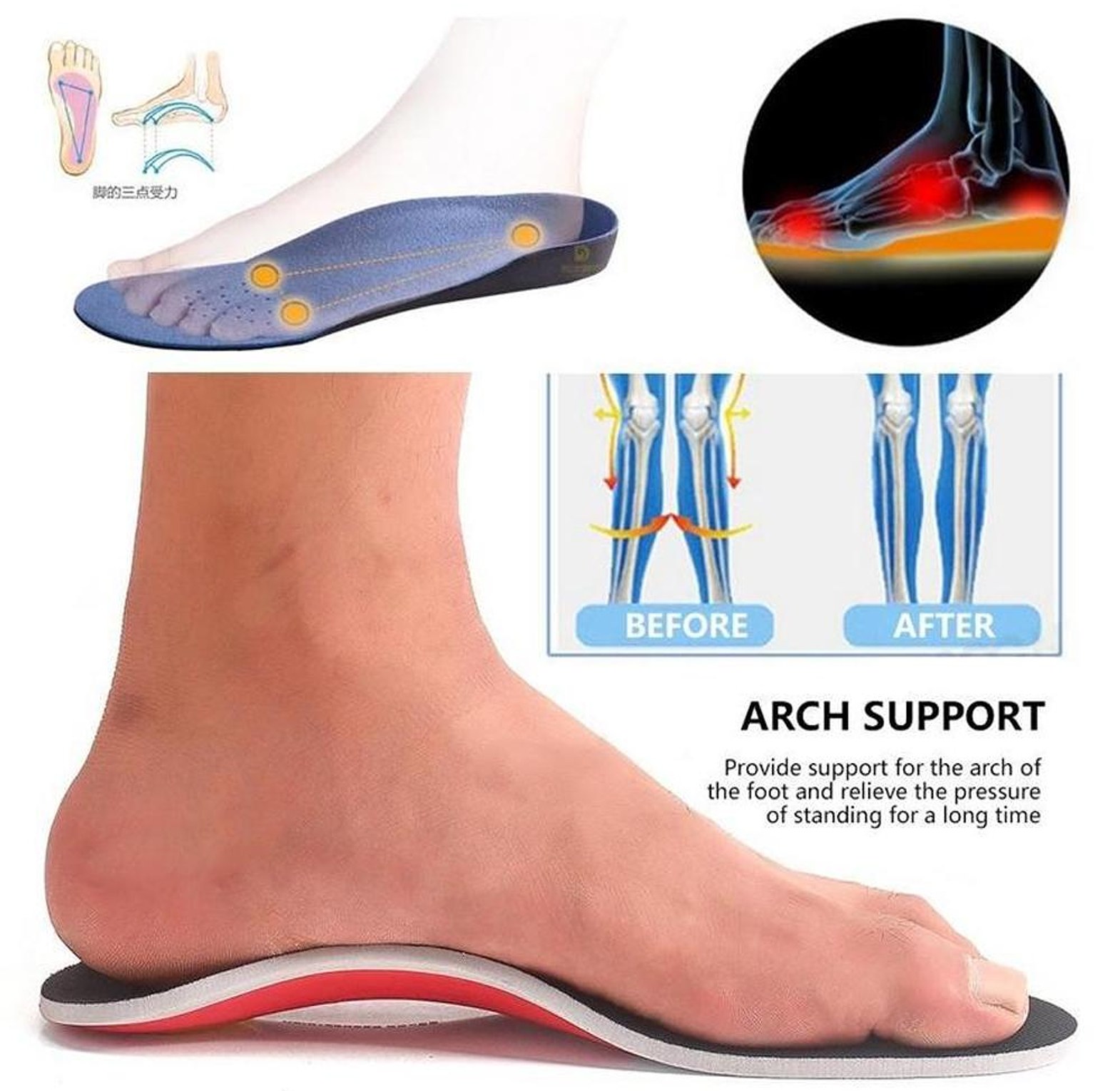 Orthopedic Shoe Insole, Flat Foot Corrector image