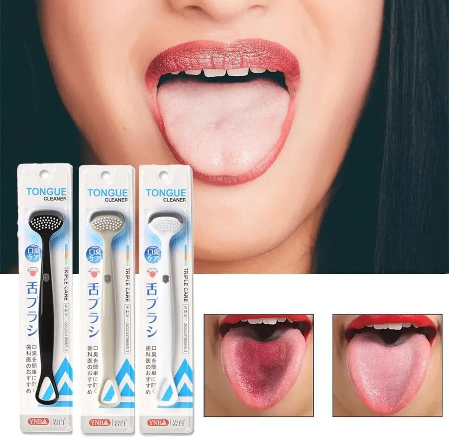 Silicone Tongue Scraper (Double-Sided) image