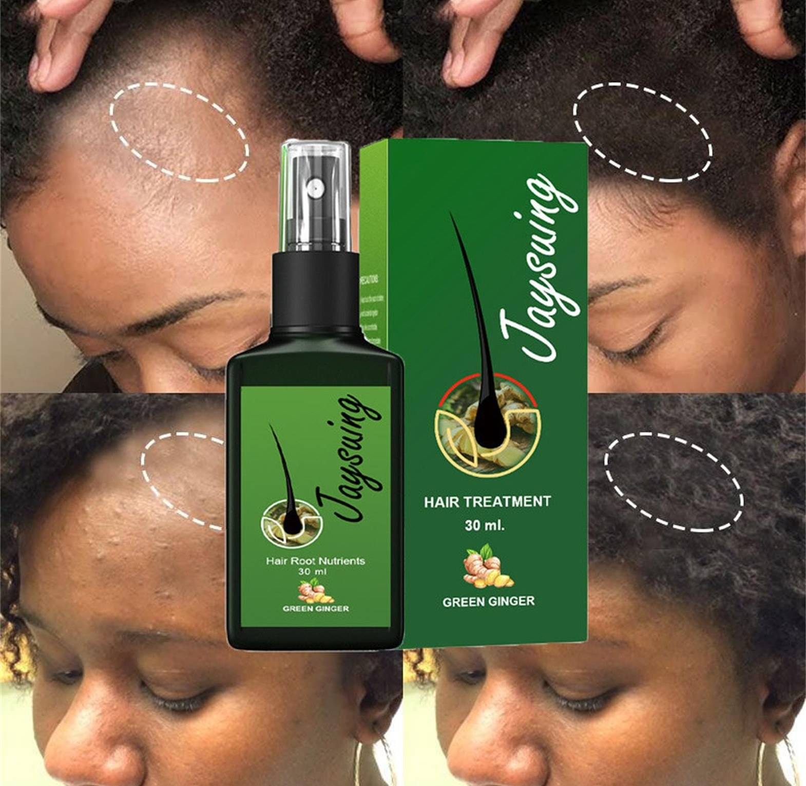 Anti-Hair Loss Tonic Hair Treatment image