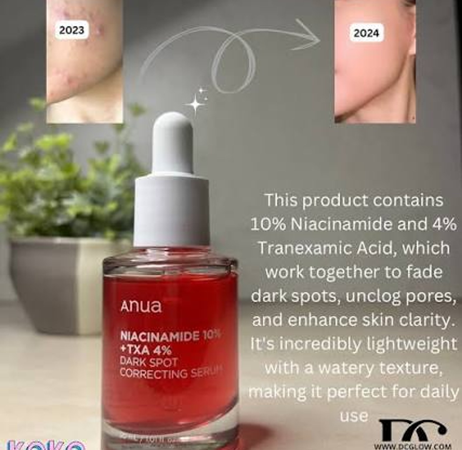 Mooyam Niacinamide 10% + TXA 4% Dark Spot Correcting Serum – 30 ml image