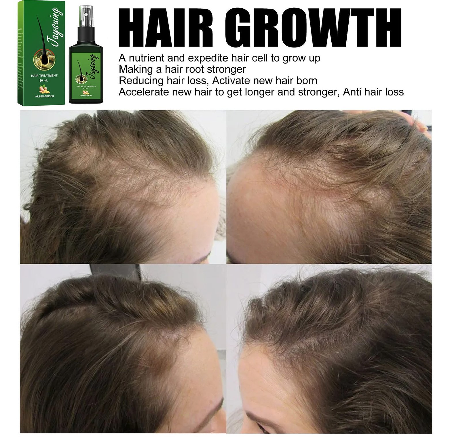 Anti-Hair Loss Tonic Hair Treatment image