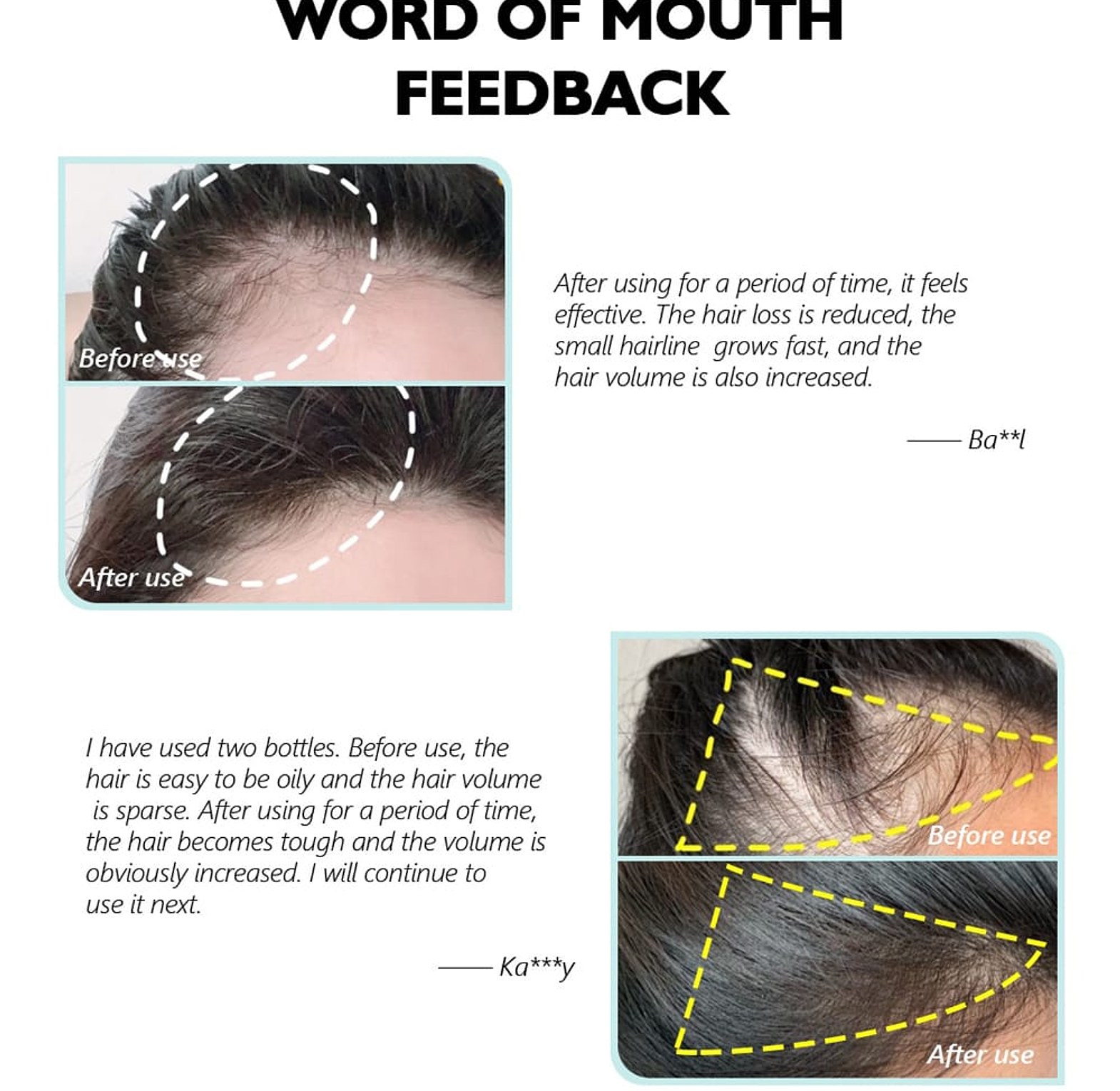 Anti-Hair Loss Tonic Hair Treatment image