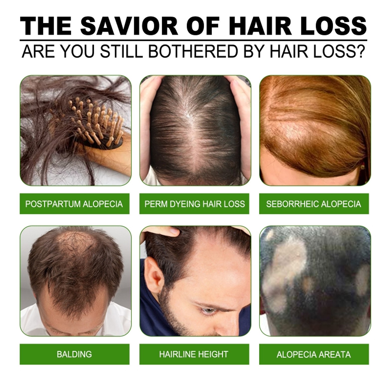 Anti-Hair Loss Tonic Hair Treatment image
