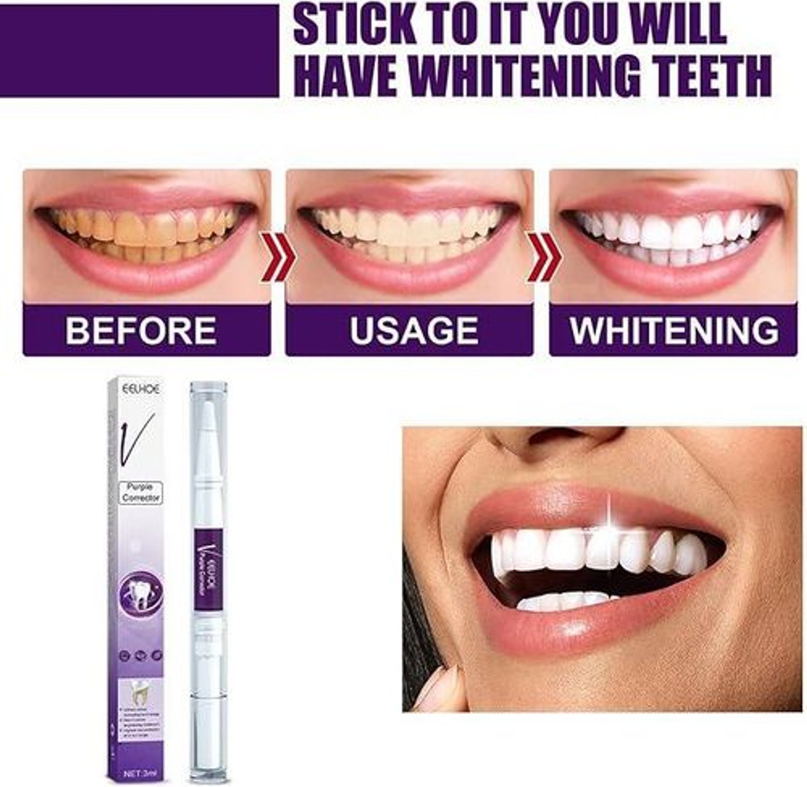 Teeth whitening pen  image