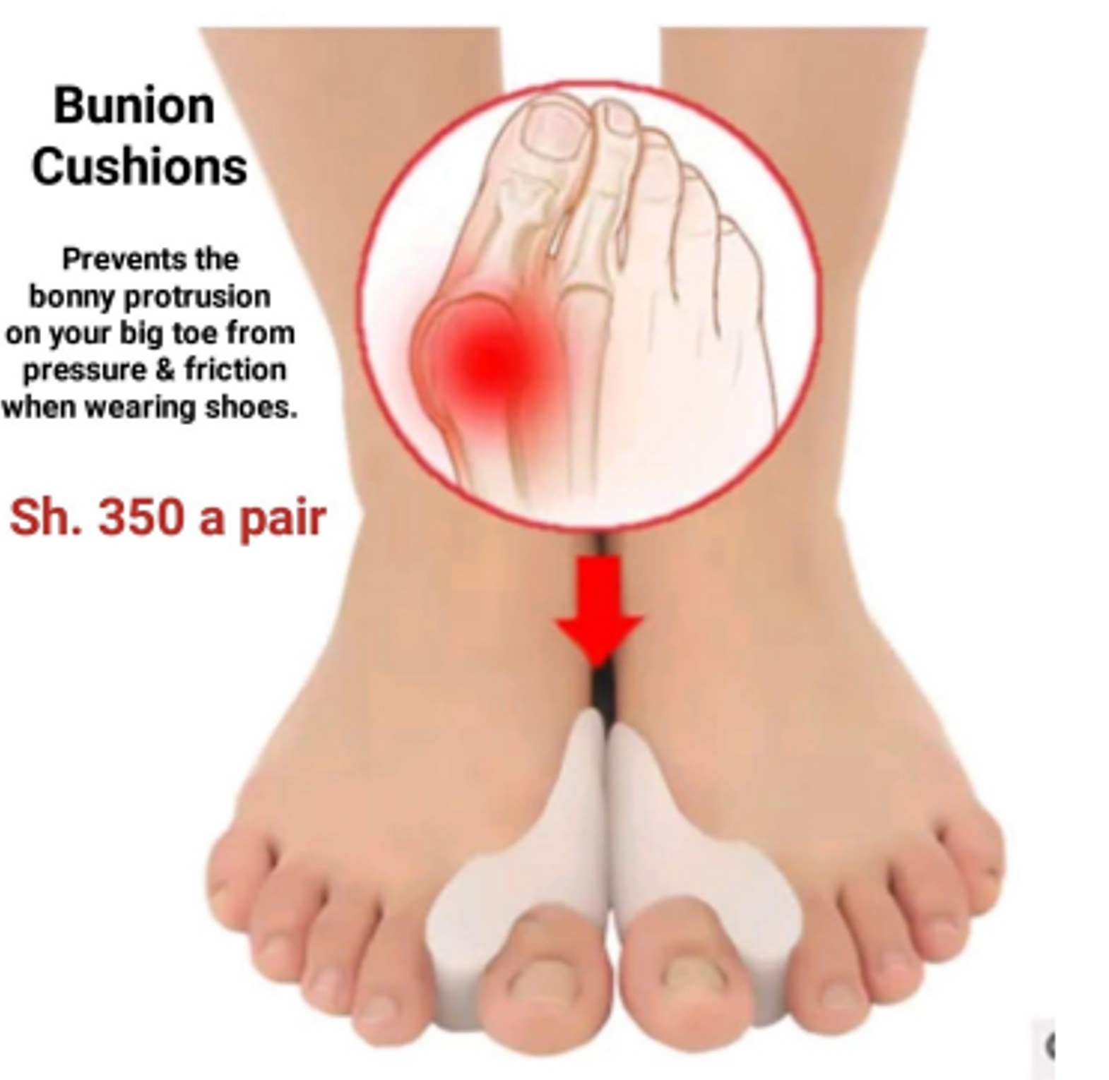 Big Toe Silicone Bunion Cushions image