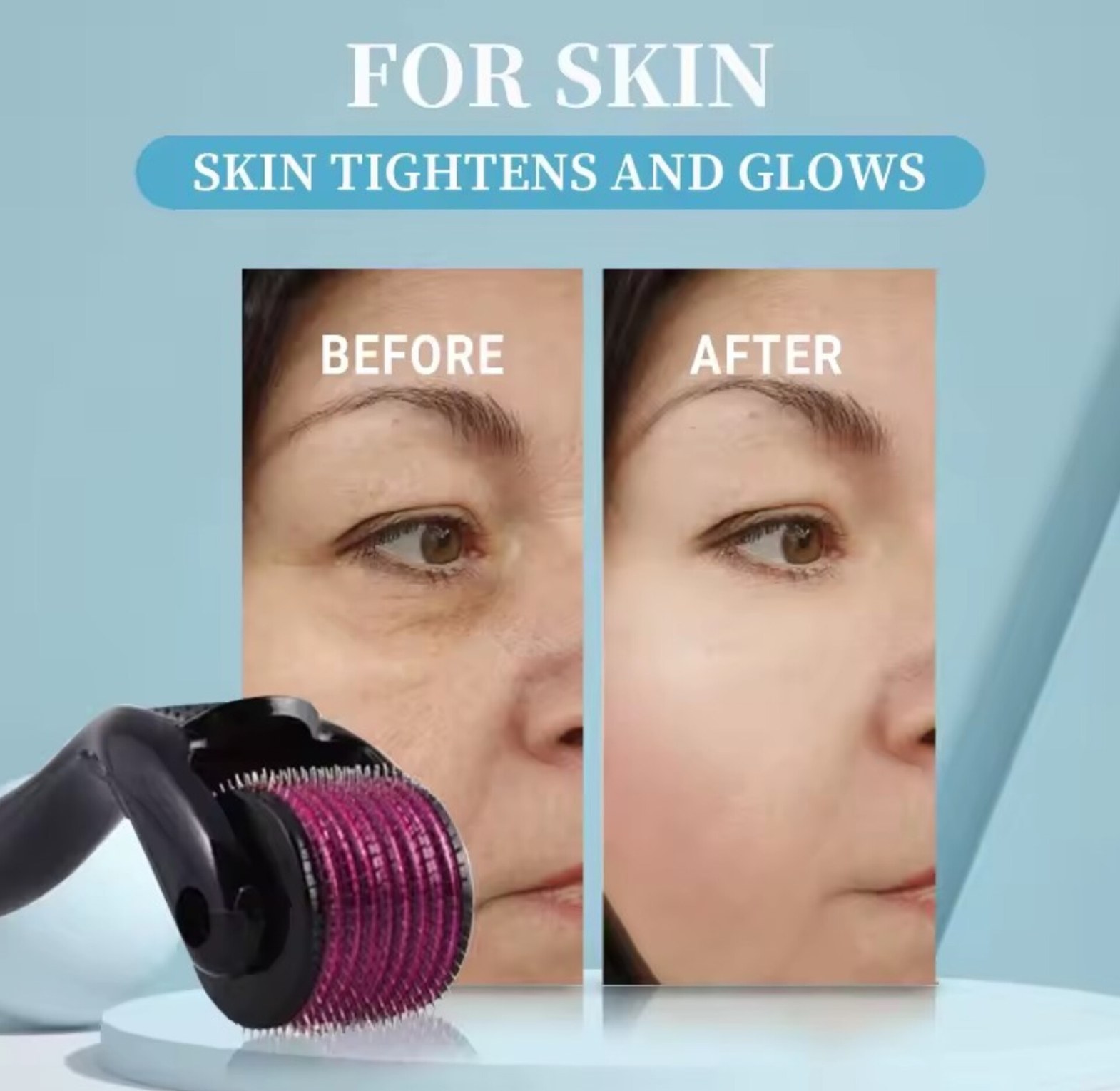 Derma Roller Microneedling Kit for Acne Scars Anti-Aging image
